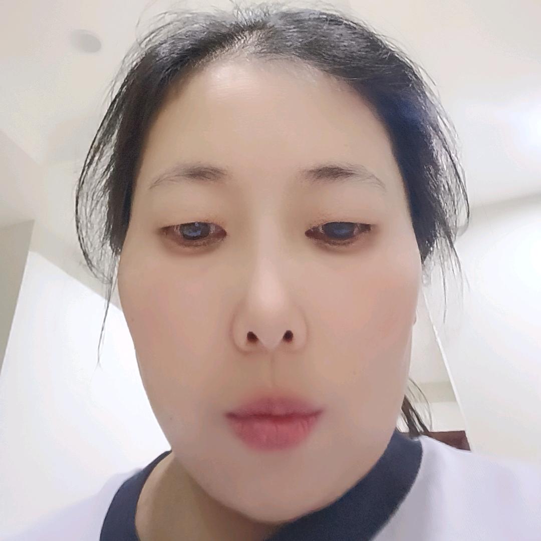 岳丽
