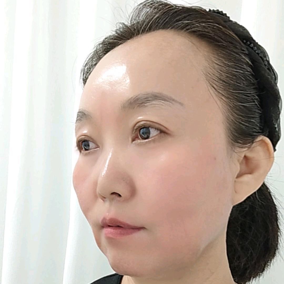 问题皮肤终结者