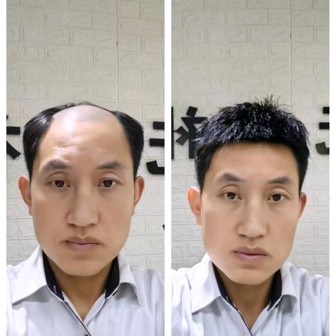 延安周师假发补发定制 周杰造型