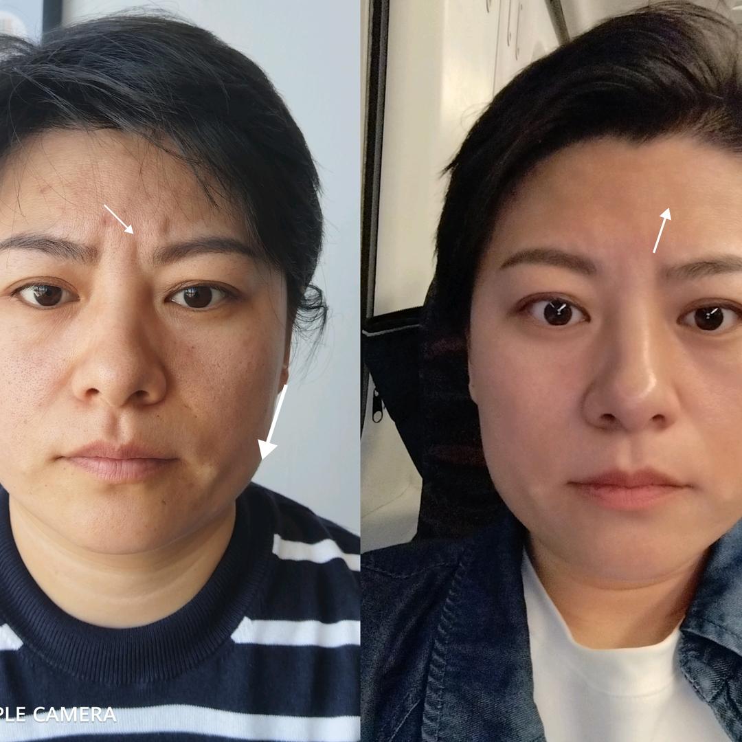 长春文川盛颜骨相美陈智荟