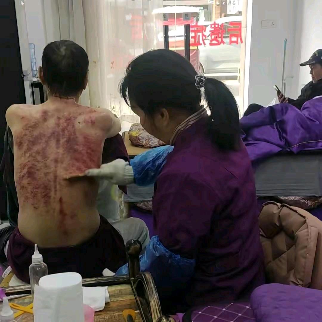 全息经络刮痧拍打