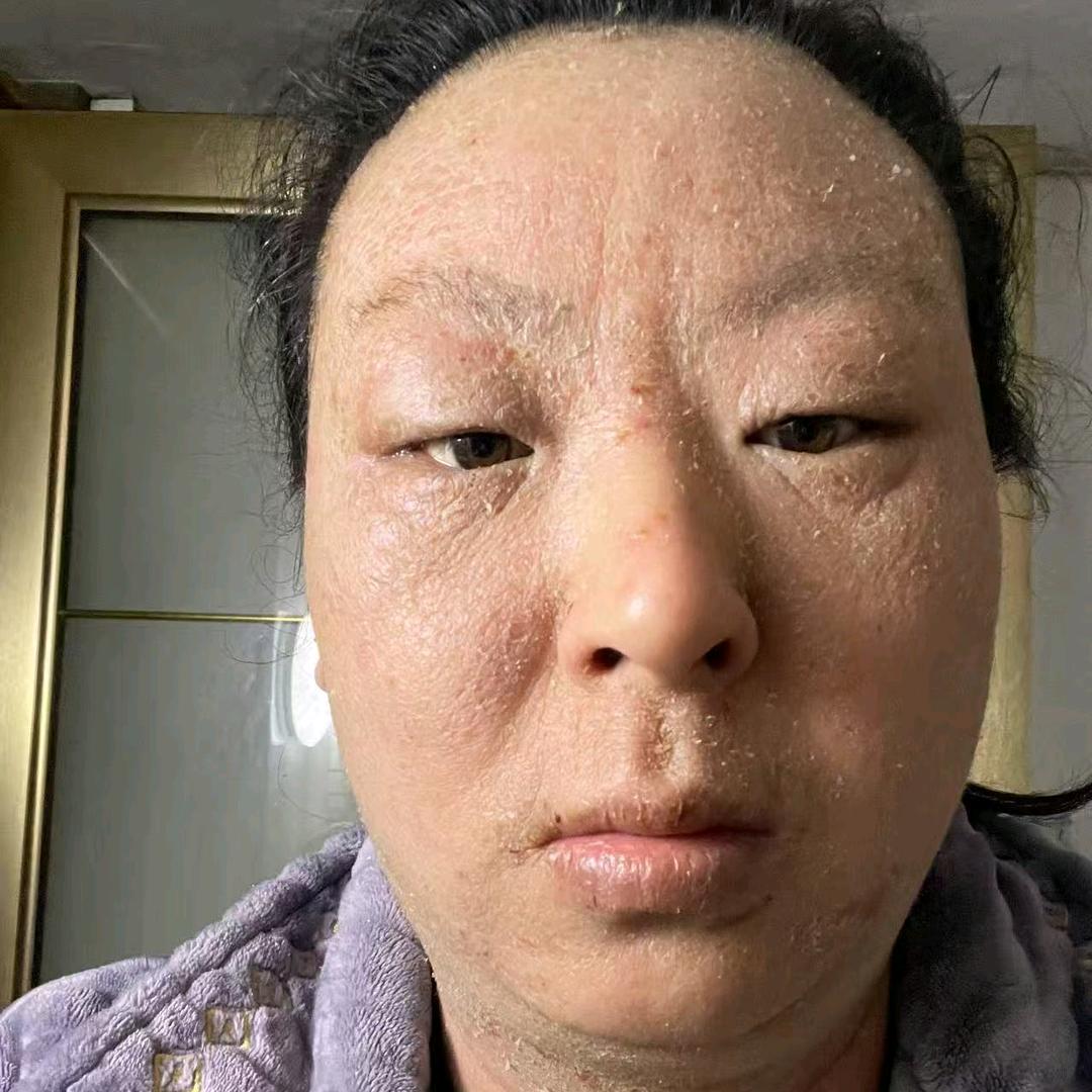 琪琪蜕变中