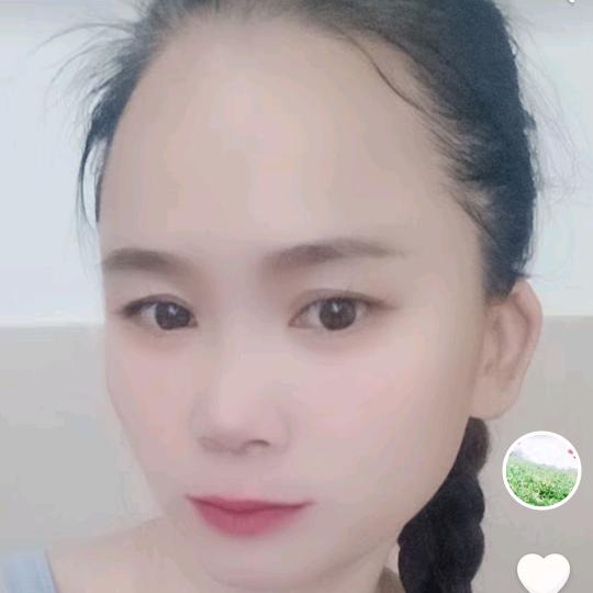 丑丫头