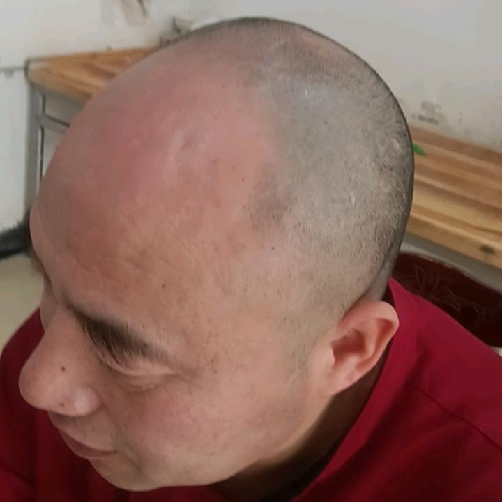 宁陵海滨脱发已上岸(橱窗好物一对一指导)