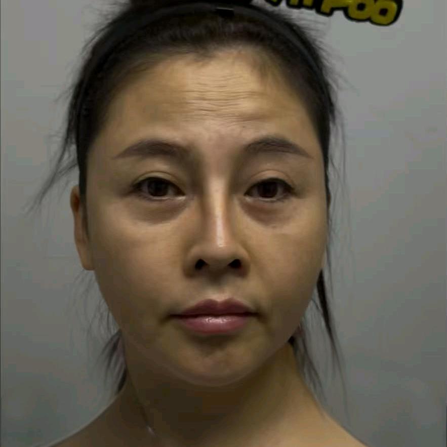 转转，