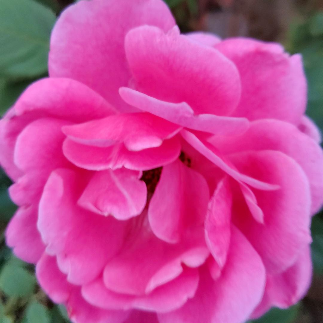 艳姐，透析日常