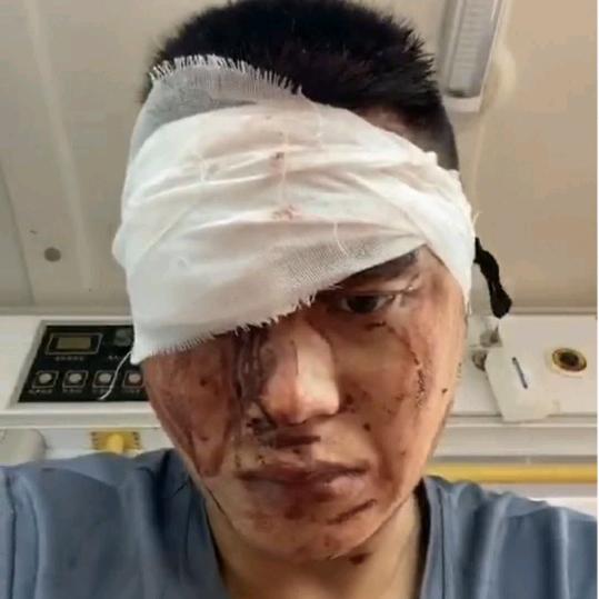 我的身份证名字叫高飞我是个母猪疯病犯病者