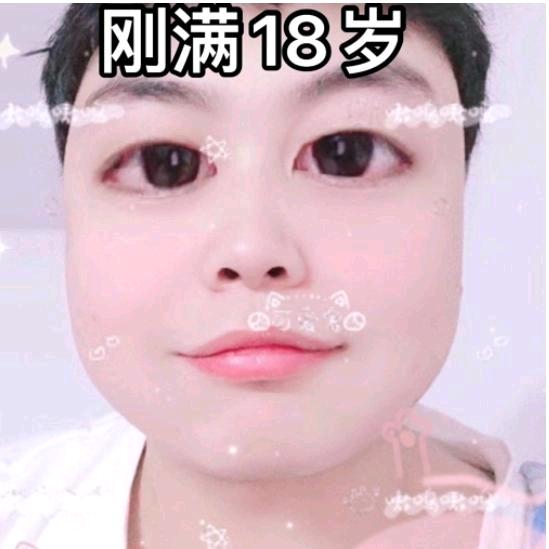 丘卡比