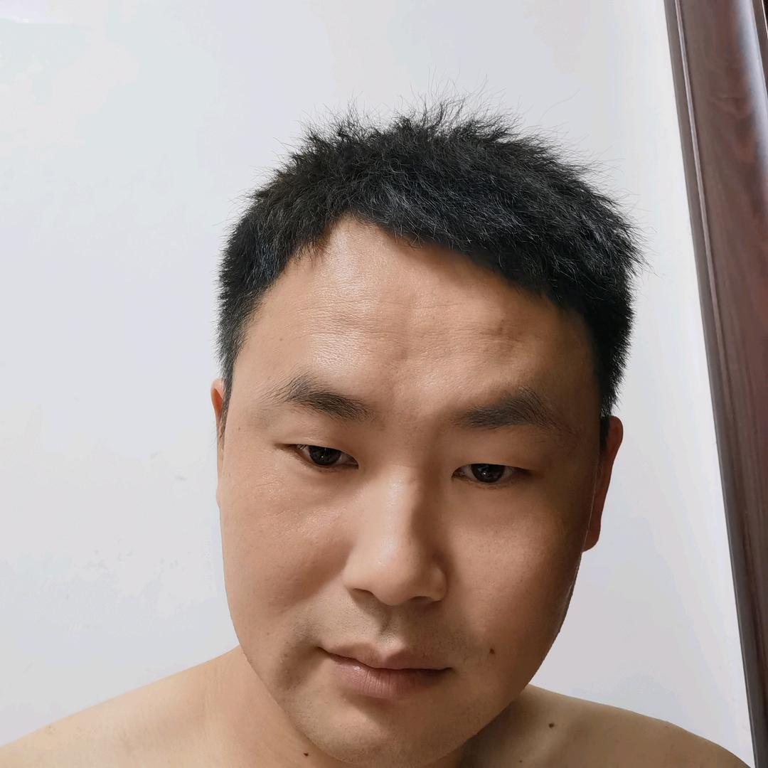 失忆