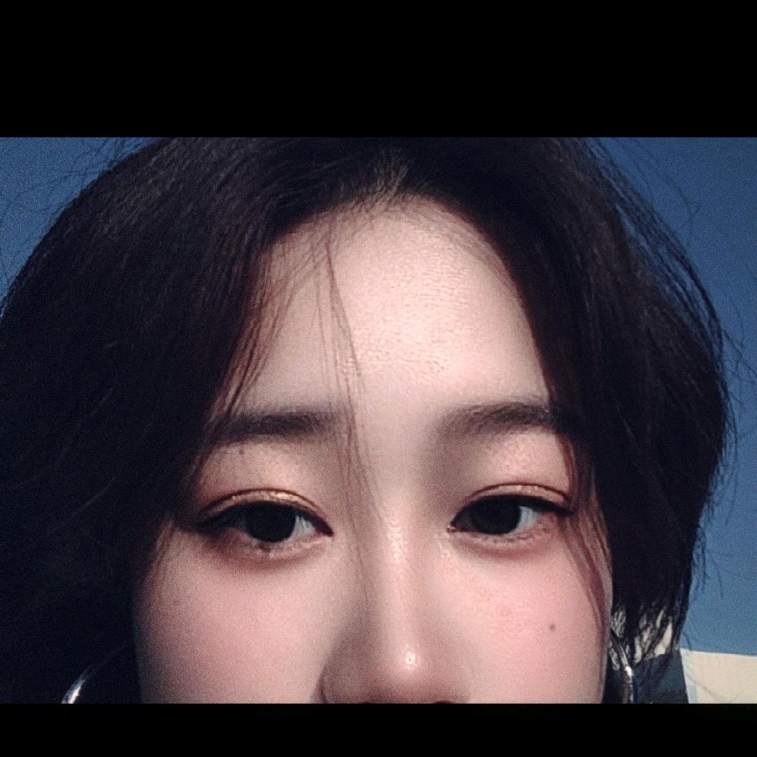 苏苏（骨折版）