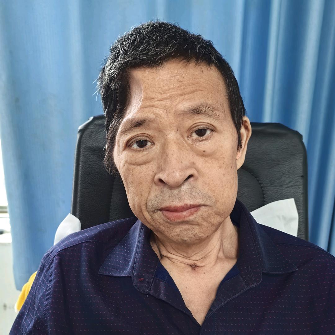 二婚男人二次脑梗