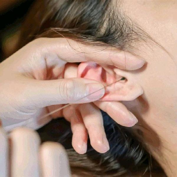 采耳（传播传统耳文化）