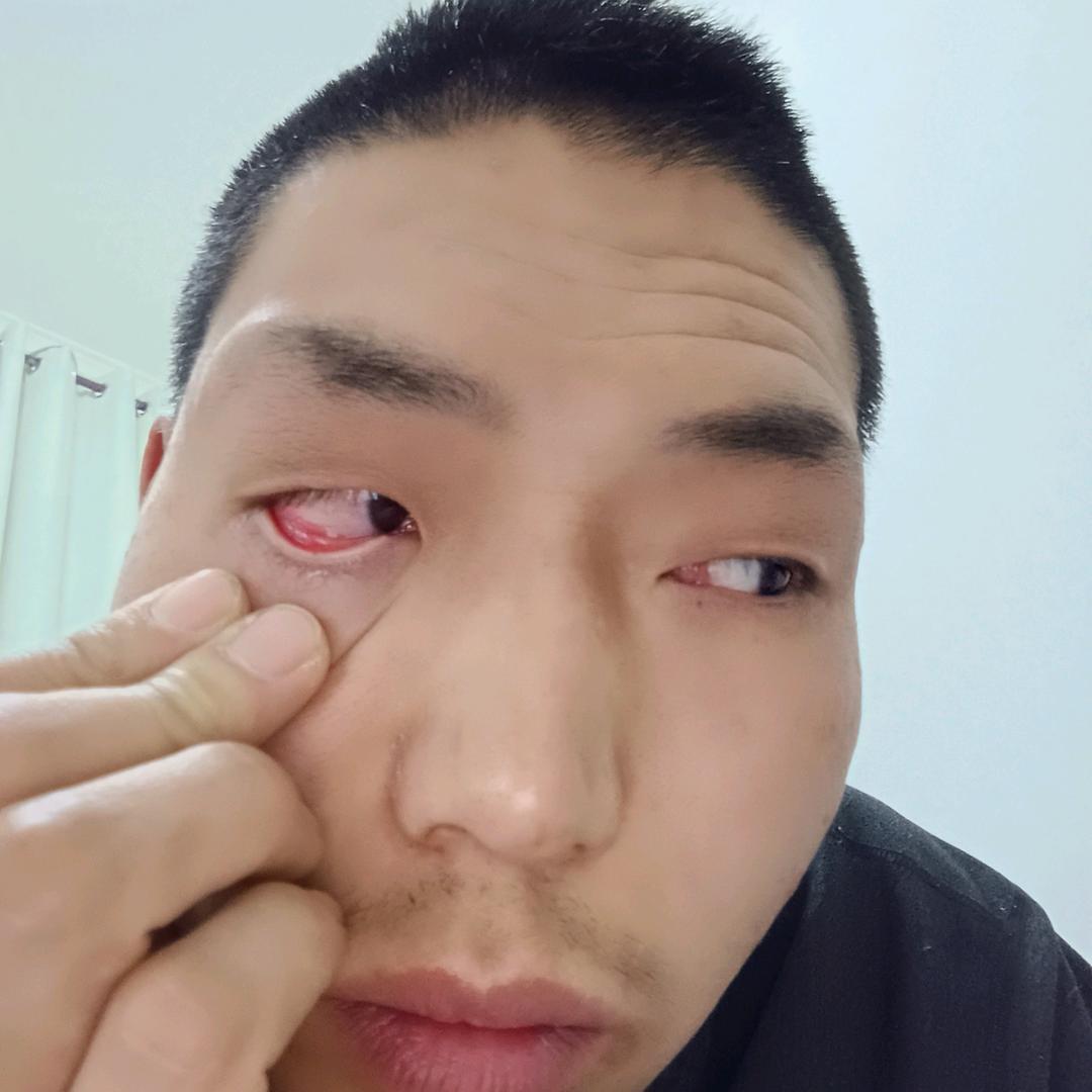 嚄坡头