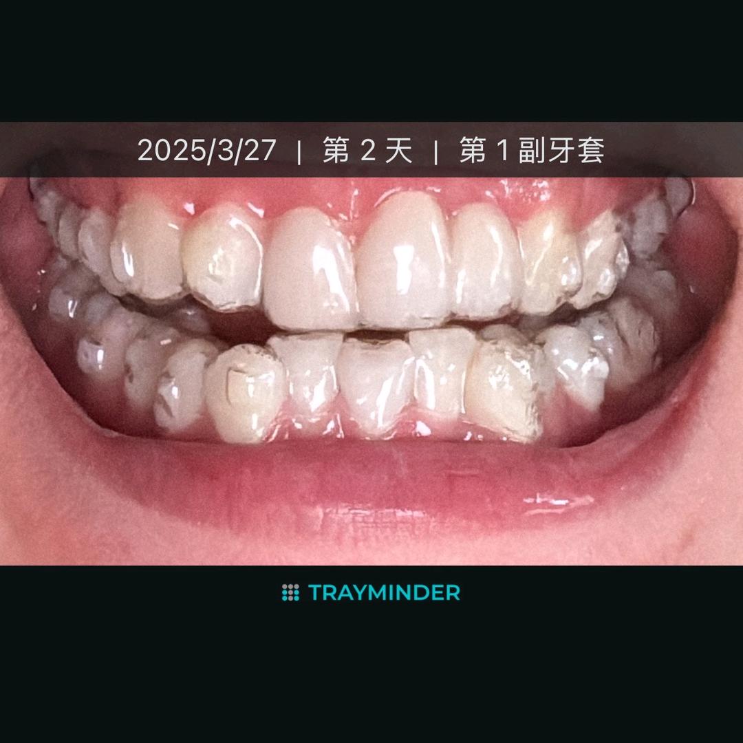 小玄