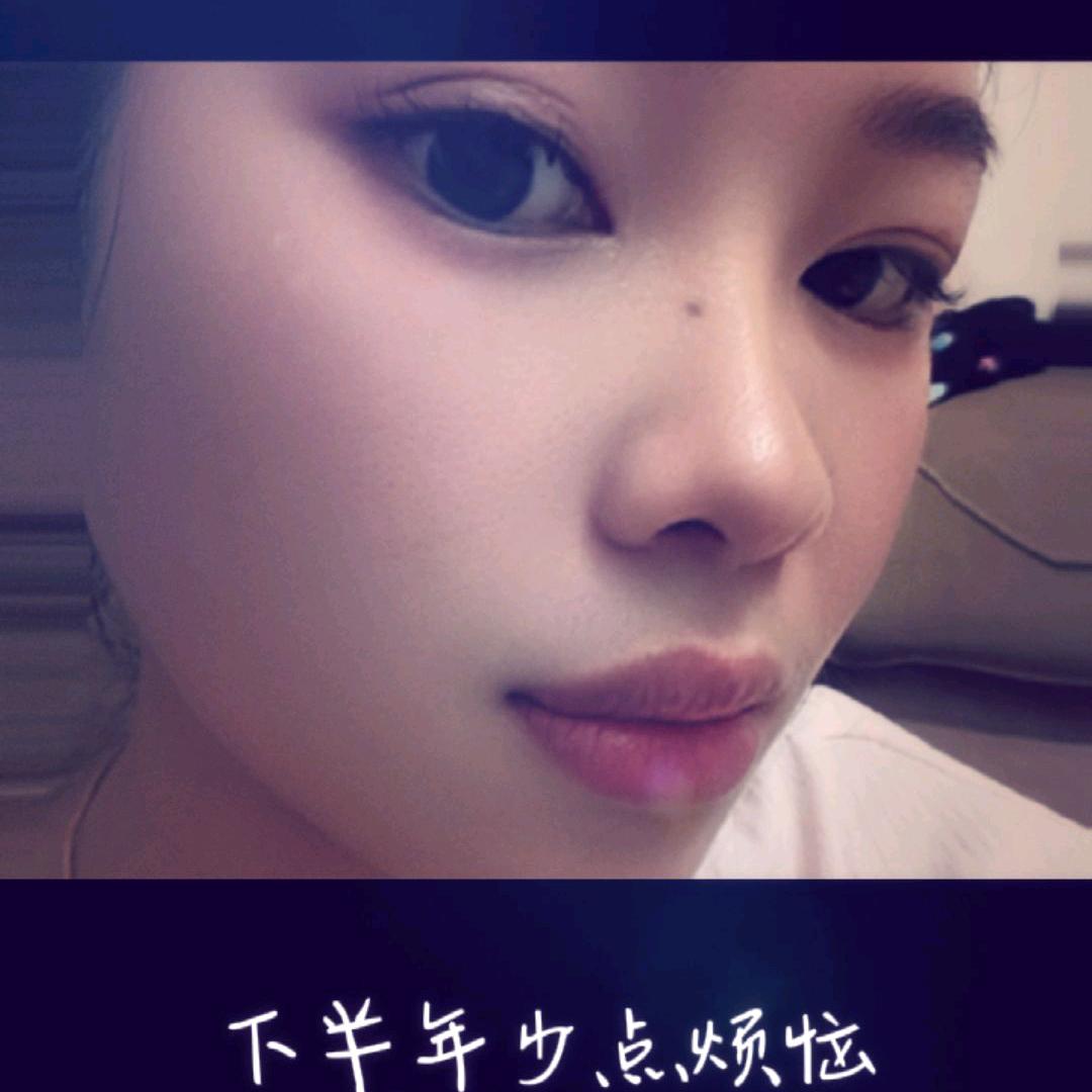 冰🧊冰