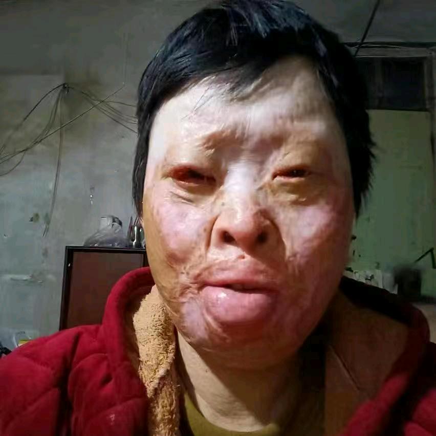 丑女人（）