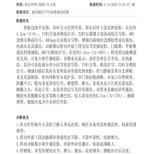 一个肝癌患者的历程