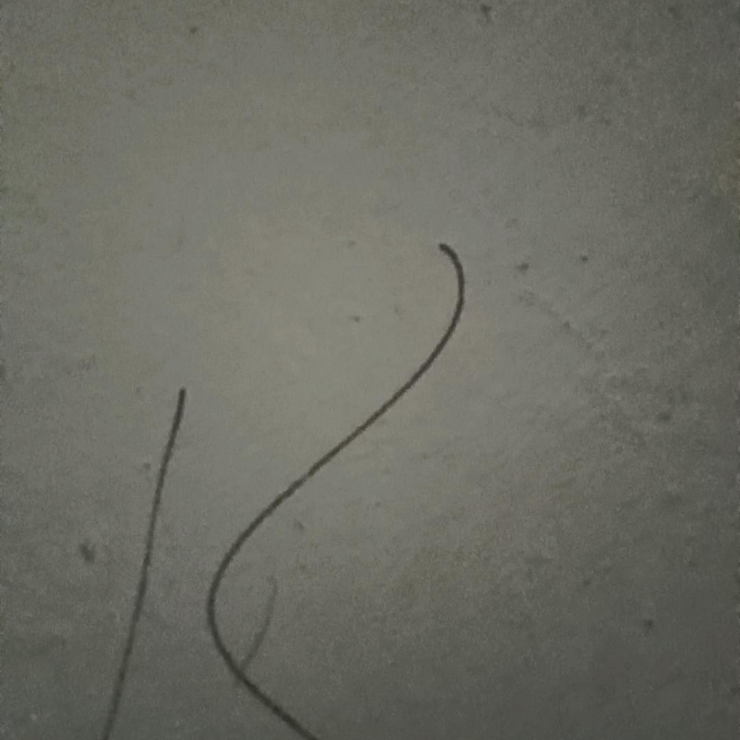 雨点