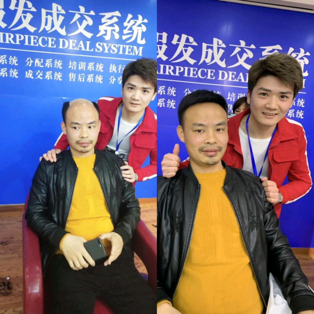 假发℡高县速美假发、接发℡俊波(收头发)