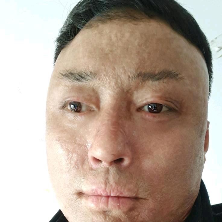 烧伤哥《助农》