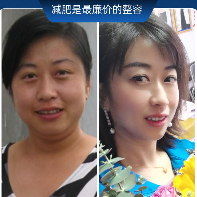 瑧瘦计划|瑞丝澜|潍坊总部