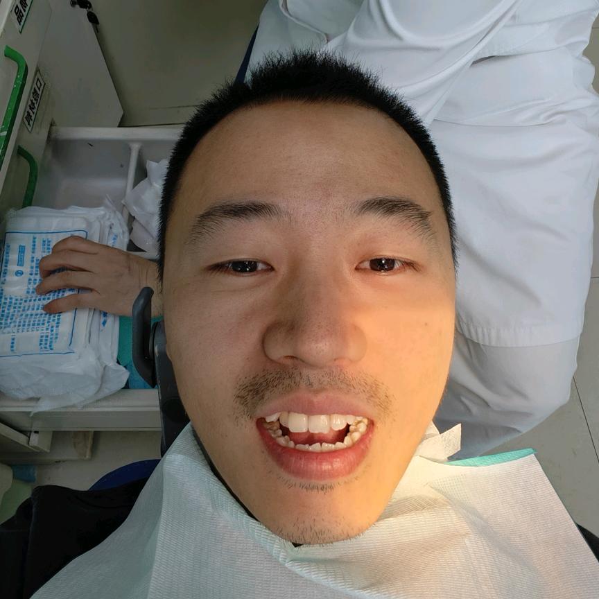 精神精