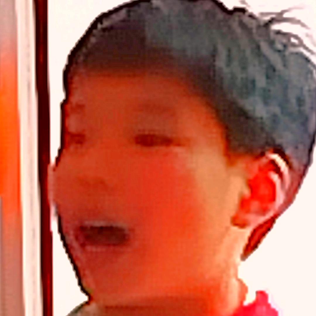 张