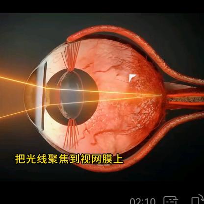 康视力