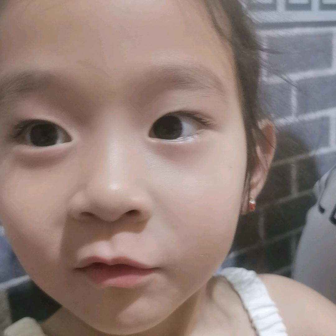 疙瘩