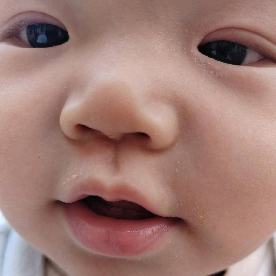 菲