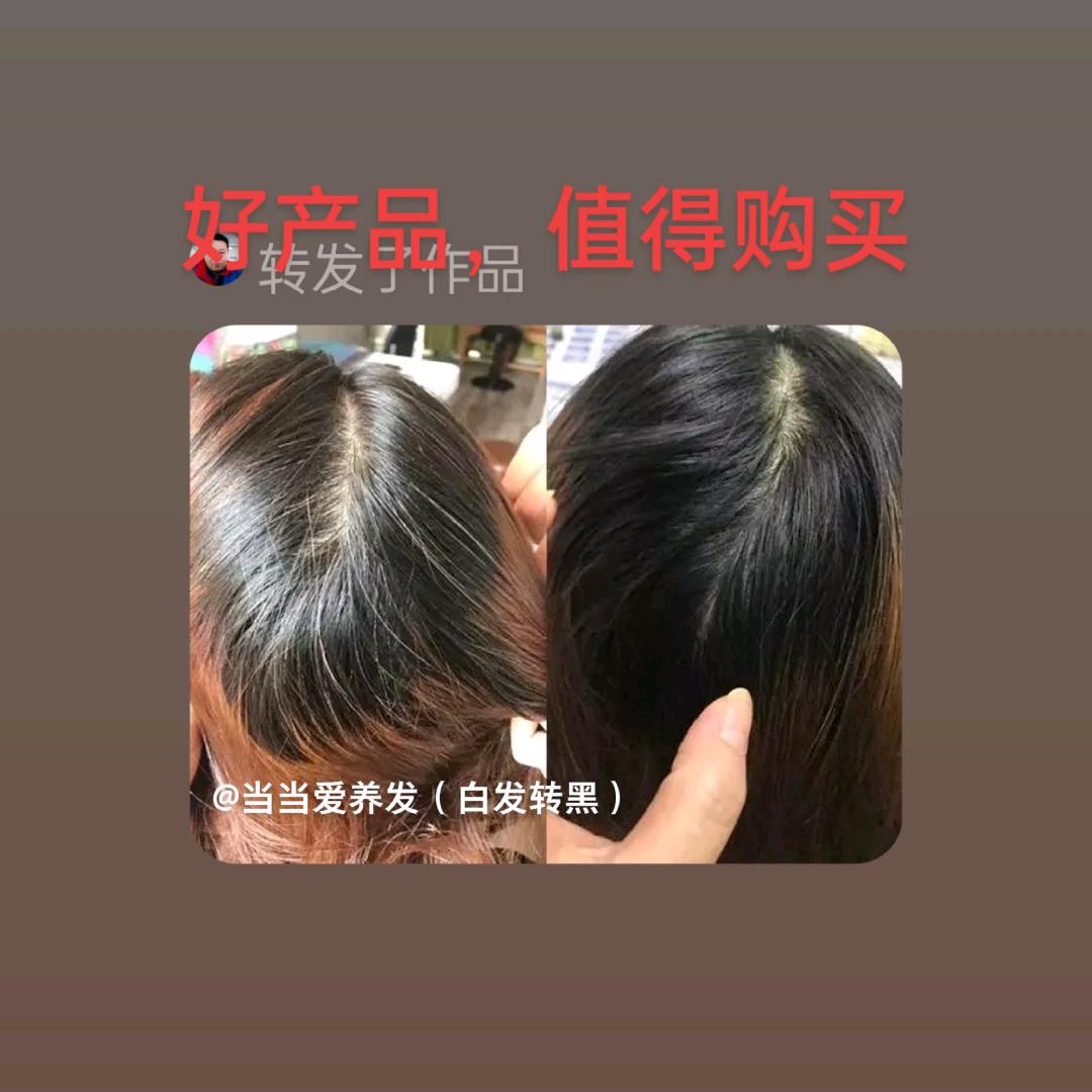 白发变黑发绝招