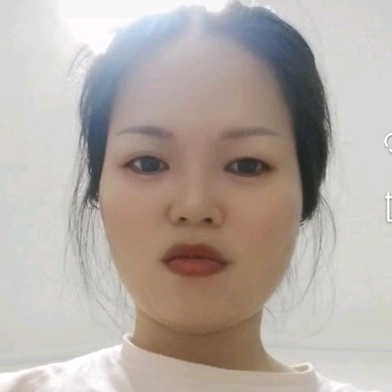 米小贝