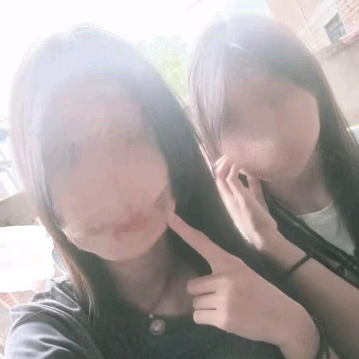 小结巴
