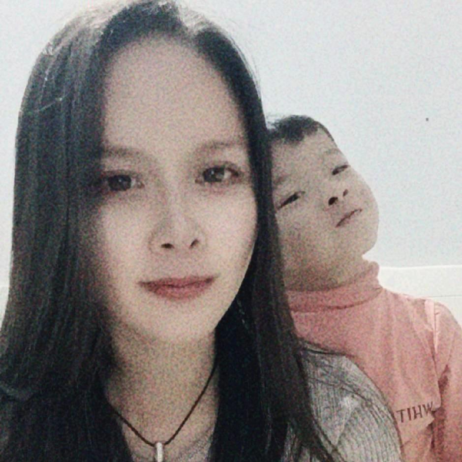 漏齿的微笑