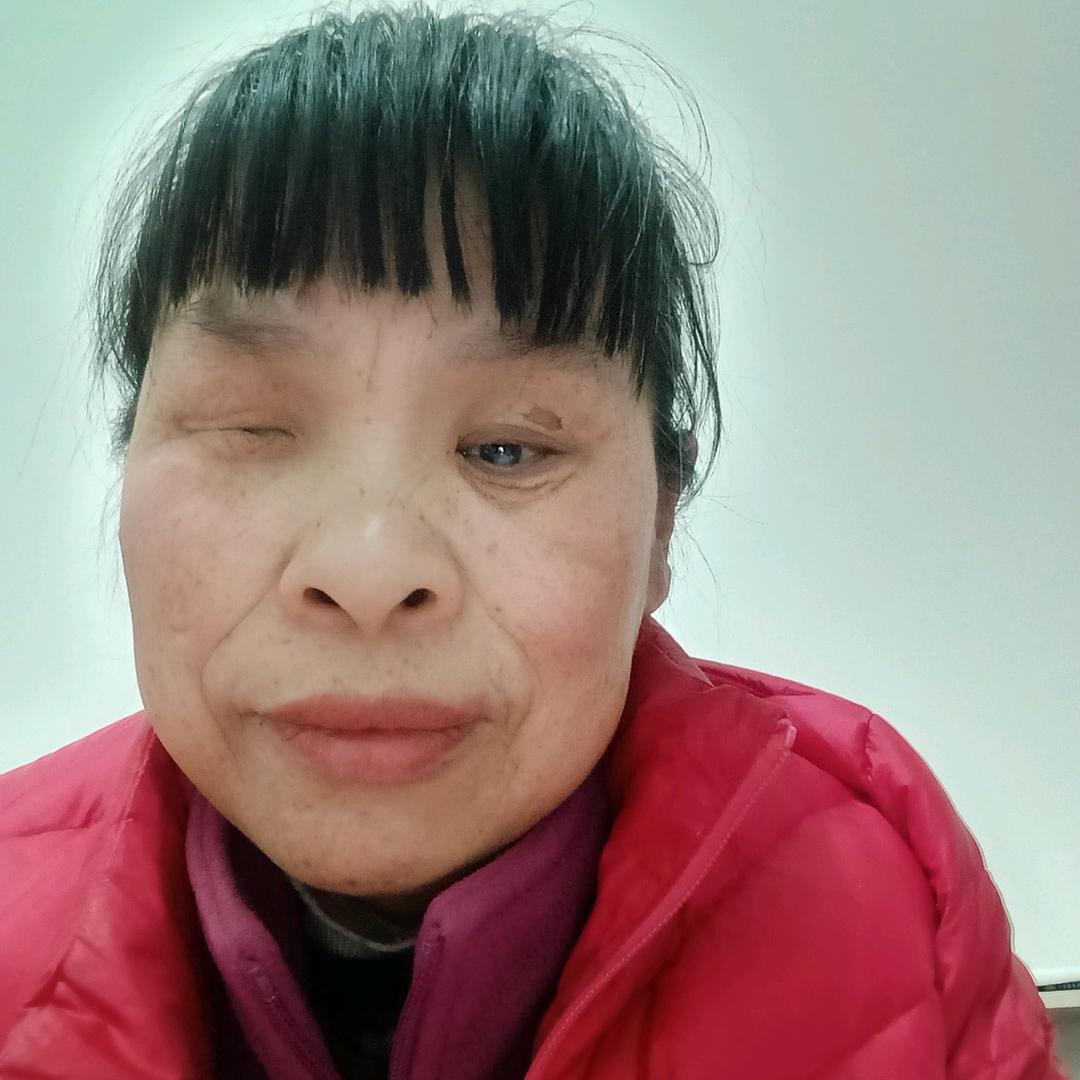 等