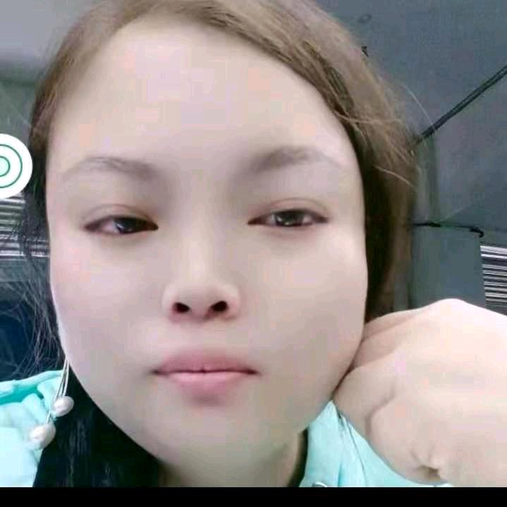 云南小林