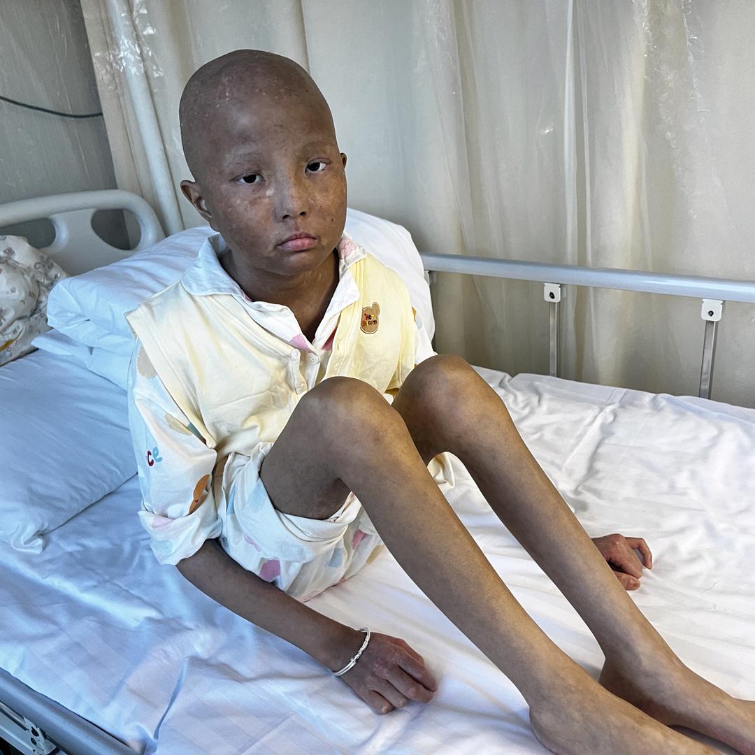 吉吉在努力（排异中）