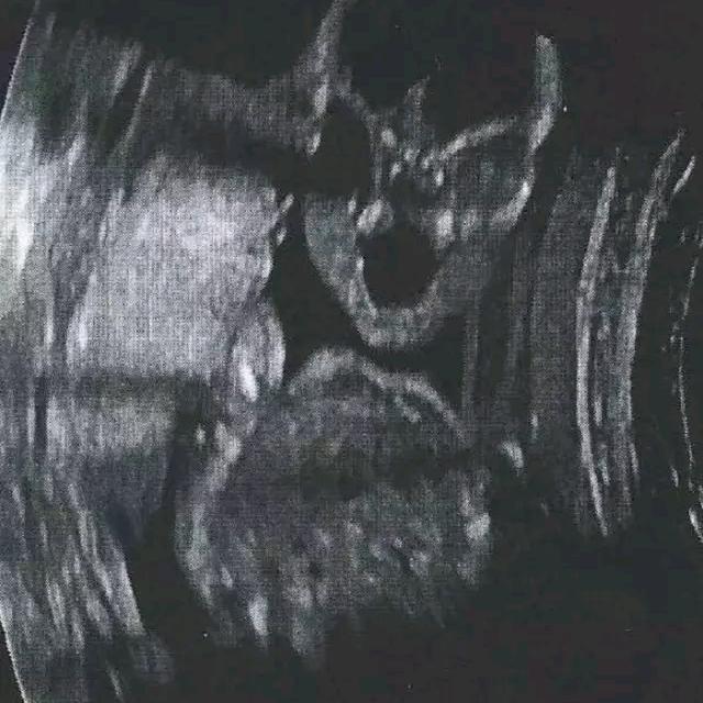怕锤子