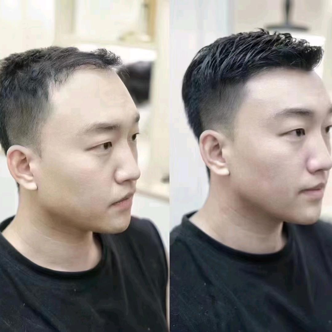 漳州男士假发精彩