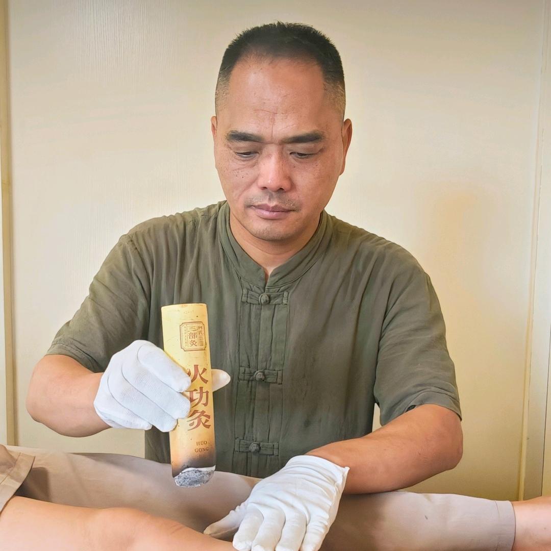 何运仲艾灸非遗传承人