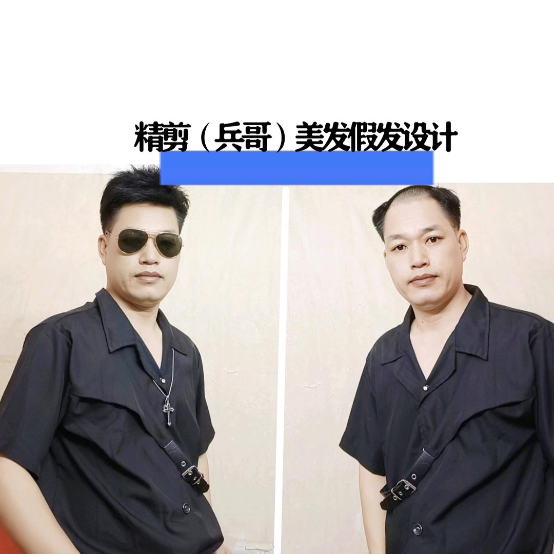 深圳兵哥假发
