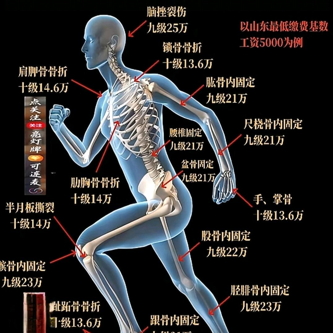 山东牛老师聊工伤