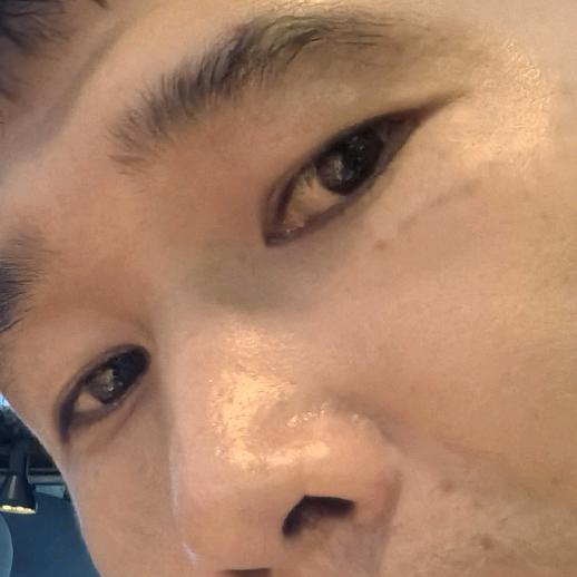 「阿叔」带你看视界