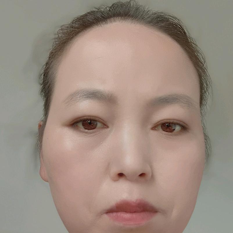 杨雪雪