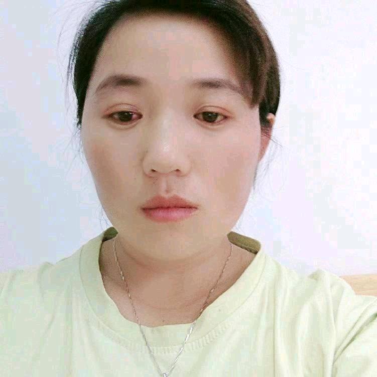 琪