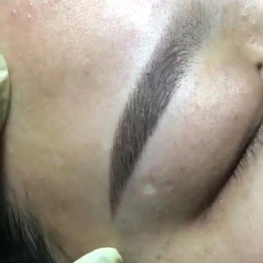 啊玲