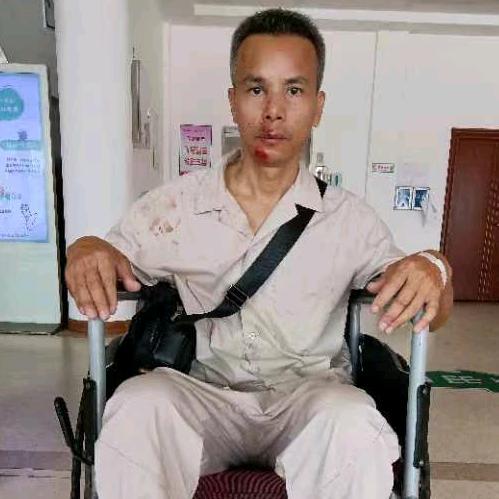 被打鼻梁骨折、腰椎骨折。