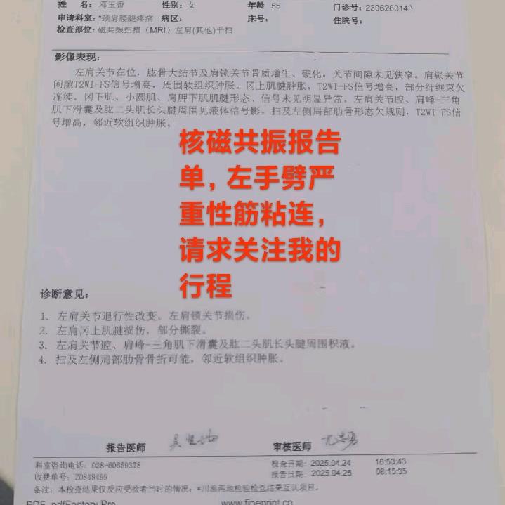 成都金牛帽子叔叔涉嫌顾胸伤银左手劈筋粘连