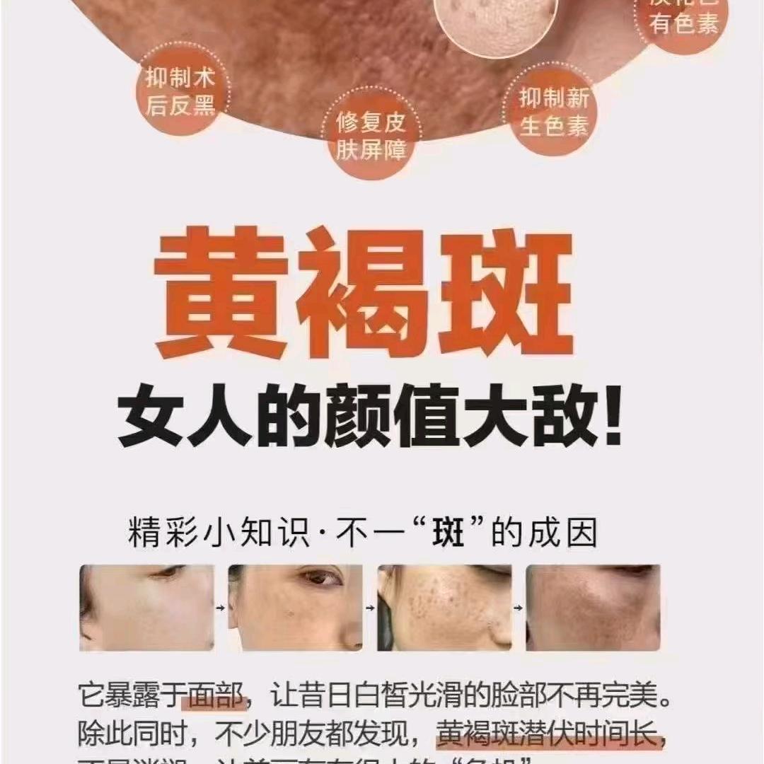 广州斑敏痘工厂