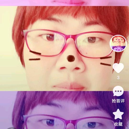 张？？？于